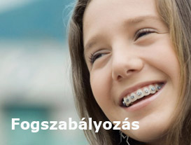 fogszabályozás felnőtteknek és gyermekeknek